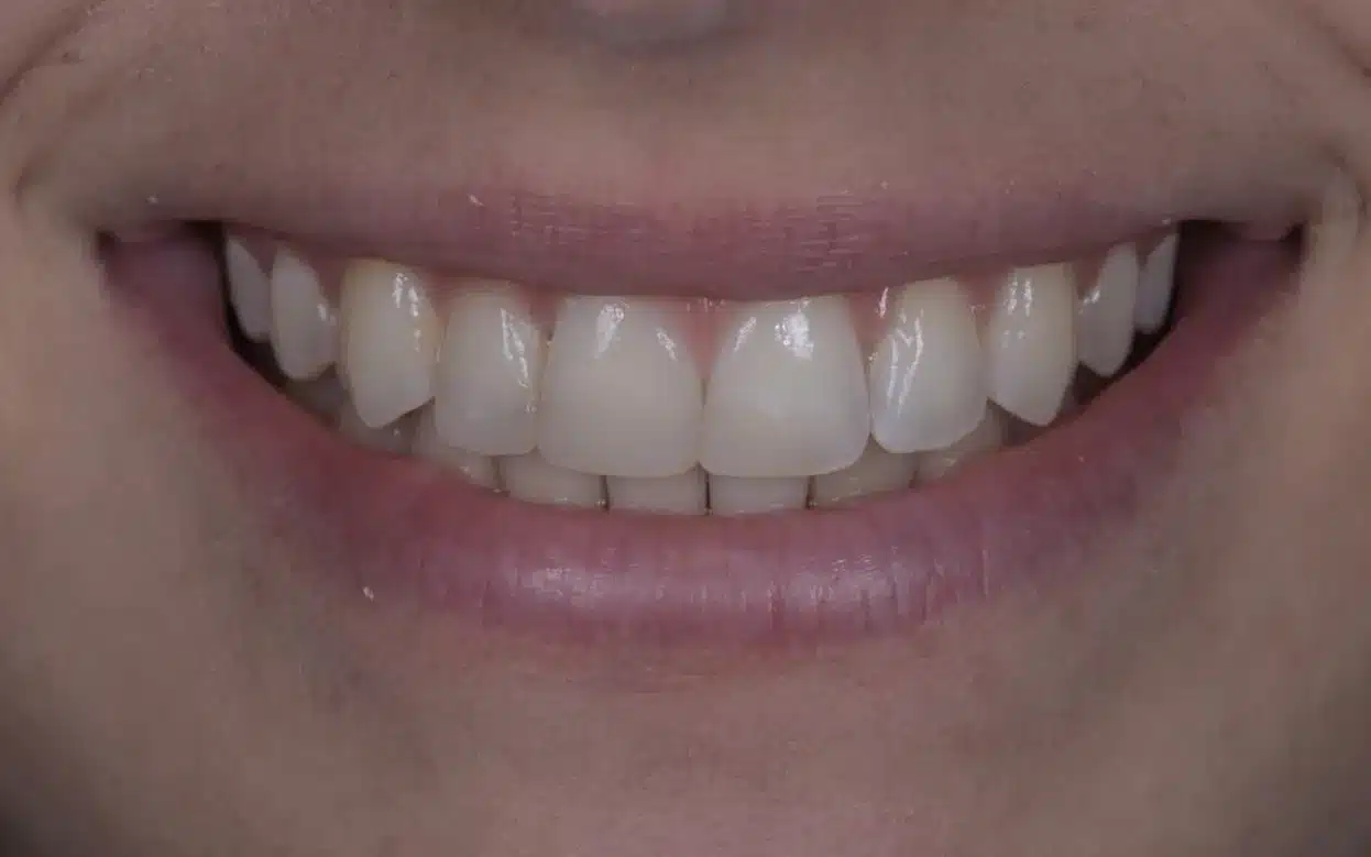 Before_Case_3-edited